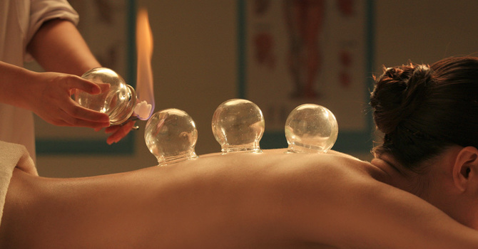 Cupping Treatment Therapy